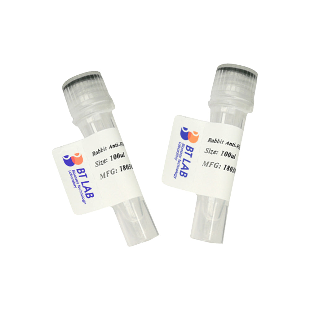 CYLD(Phospho-Ser418) Rabbit Polyclonal Antibody, 100ul