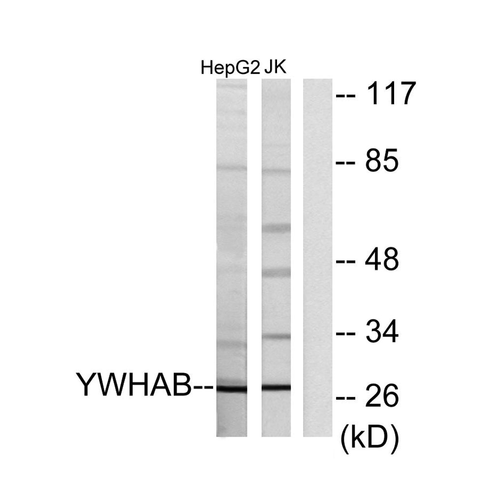 14-3-3 Beta Polyclonal Antibody, 20ul[BT-AP00003]