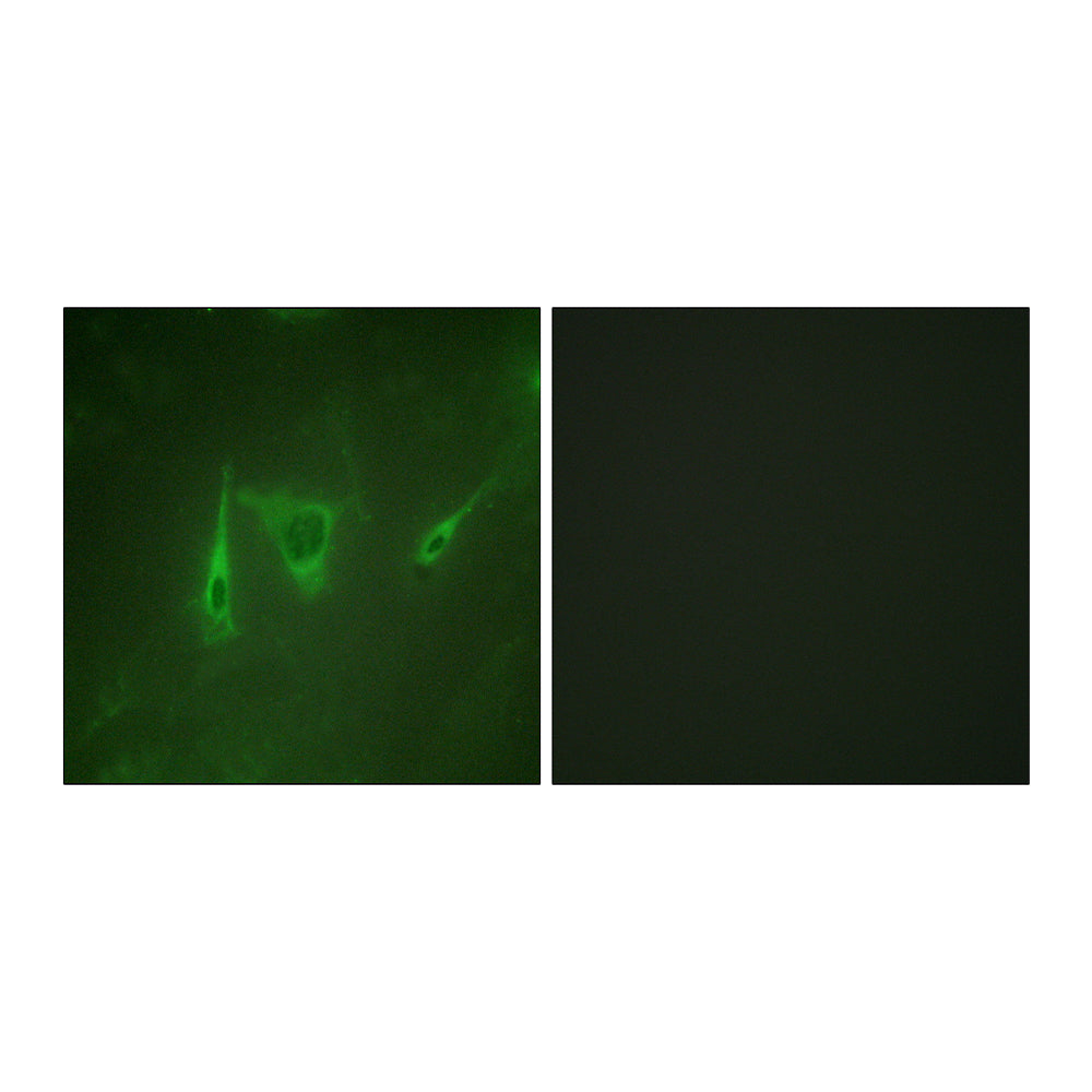 14-3-3 Zeta/Delta Polyclonal Antibody, 20ul
