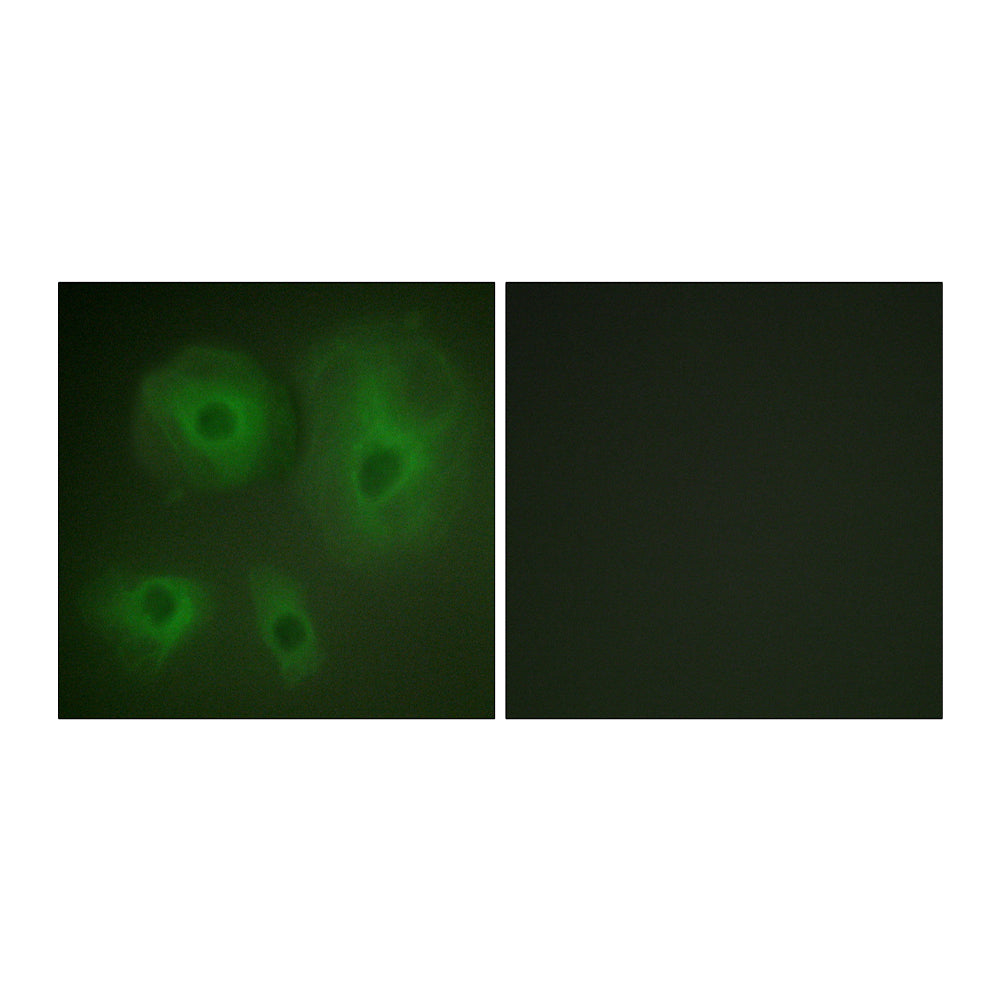 14-3-3 Theta/Tau Polyclonal Antibody, 20ul