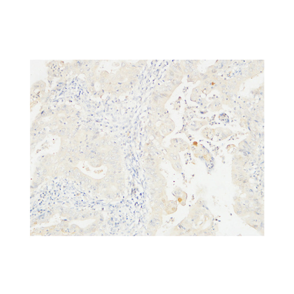 14-3-3 Sigma Polyclonal Antibody, 20ul