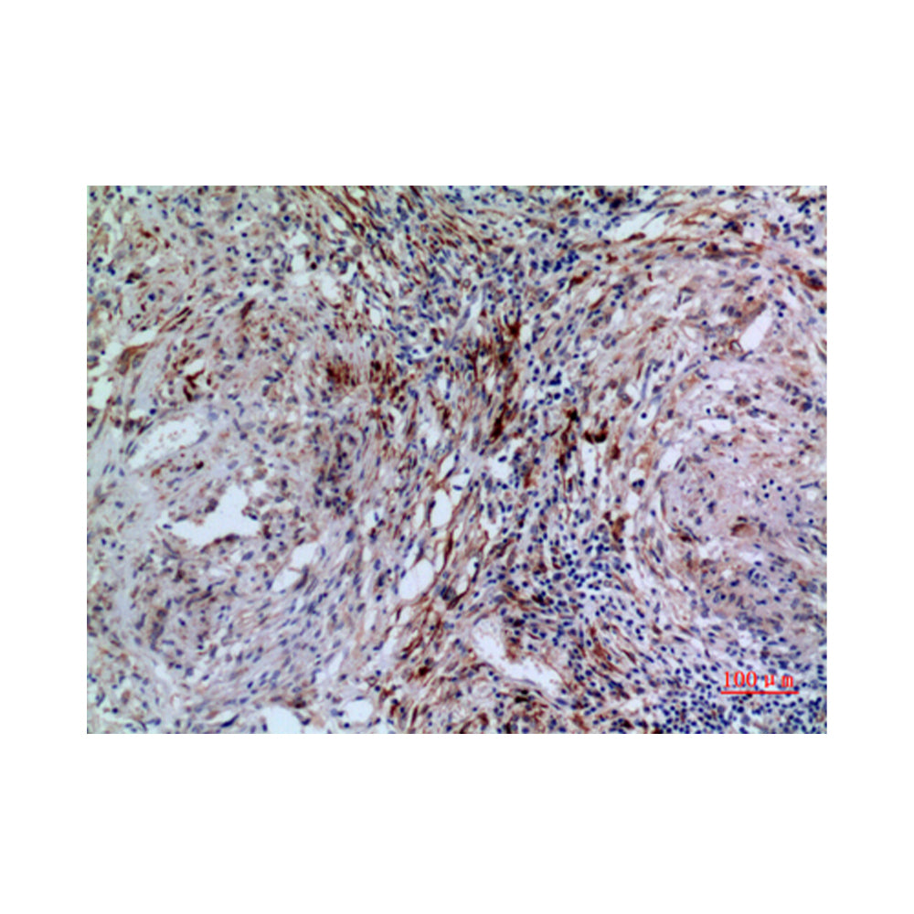 17Beta-HSD4 Polyclonal Antibody, 100ul