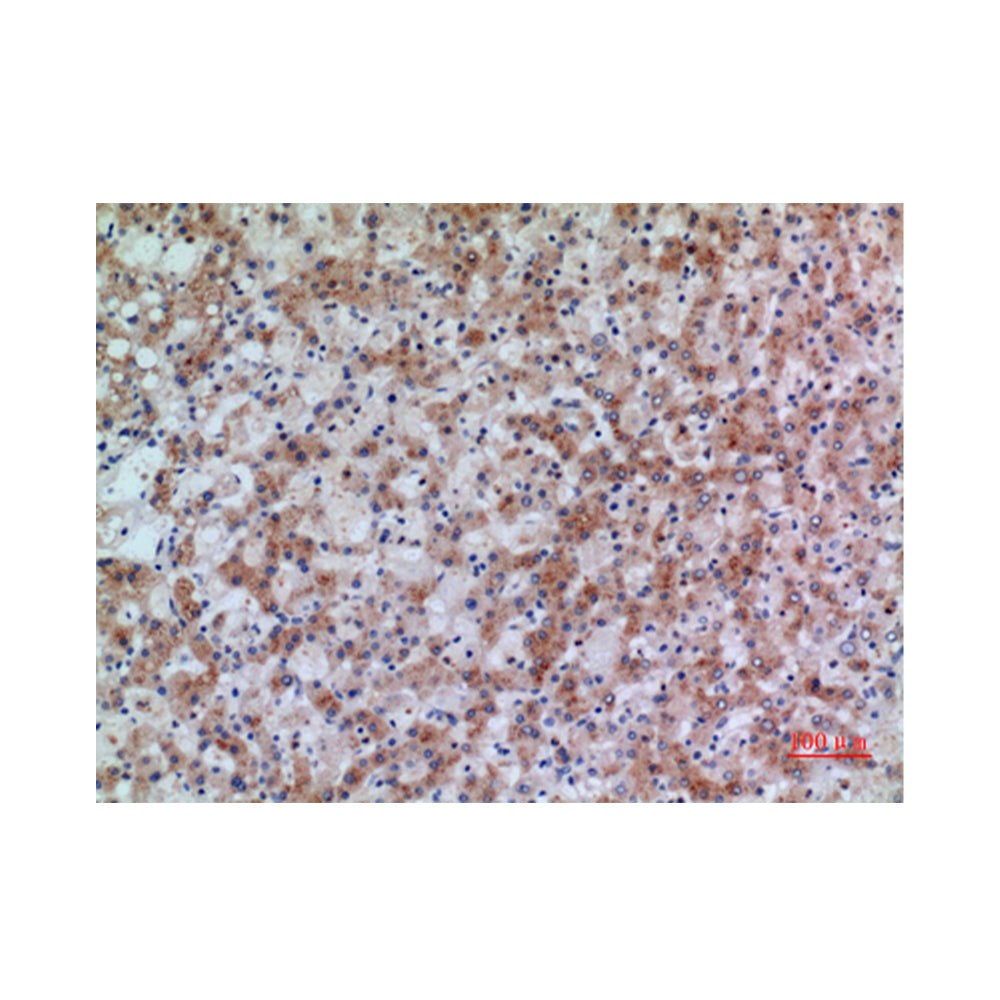 17Beta-HSD4 Polyclonal Antibody, 20ul