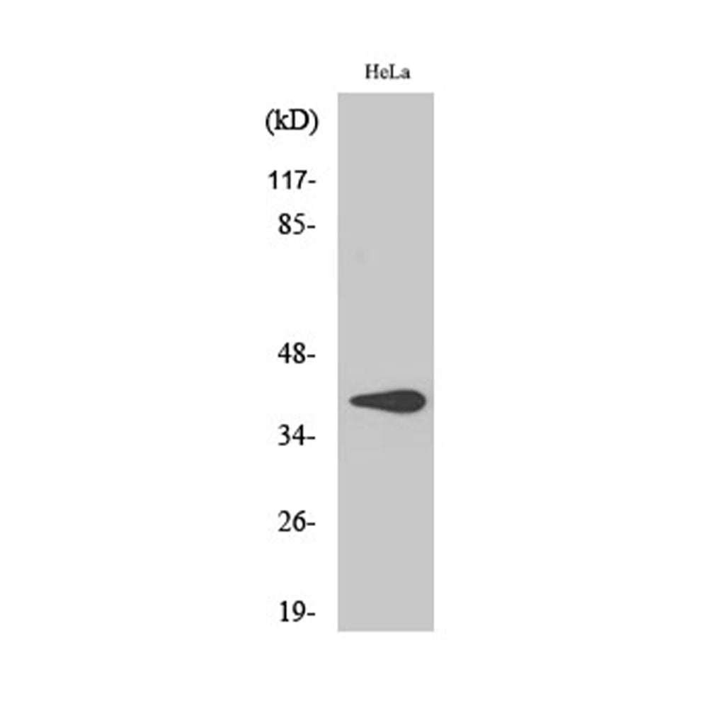 3Beta-HSD7 Polyclonal Antibody, 20ul