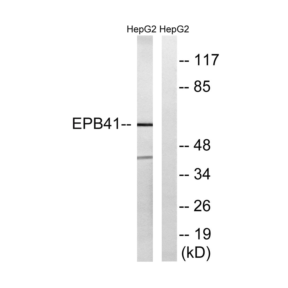 4.1R Polyclonal Antibody, 20ul