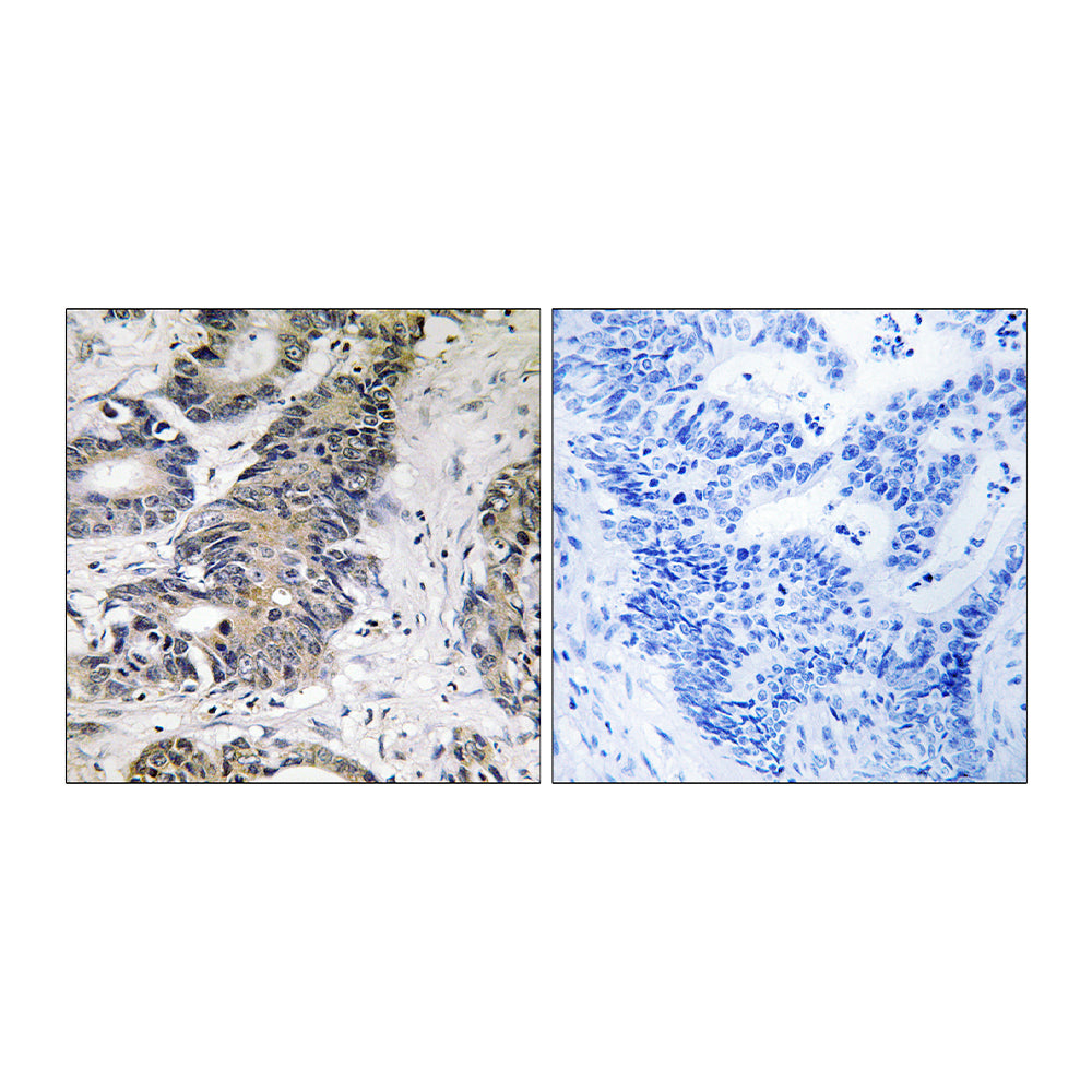 4E-BP1 Polyclonal Antibody, 20ul[BT-AP00034]