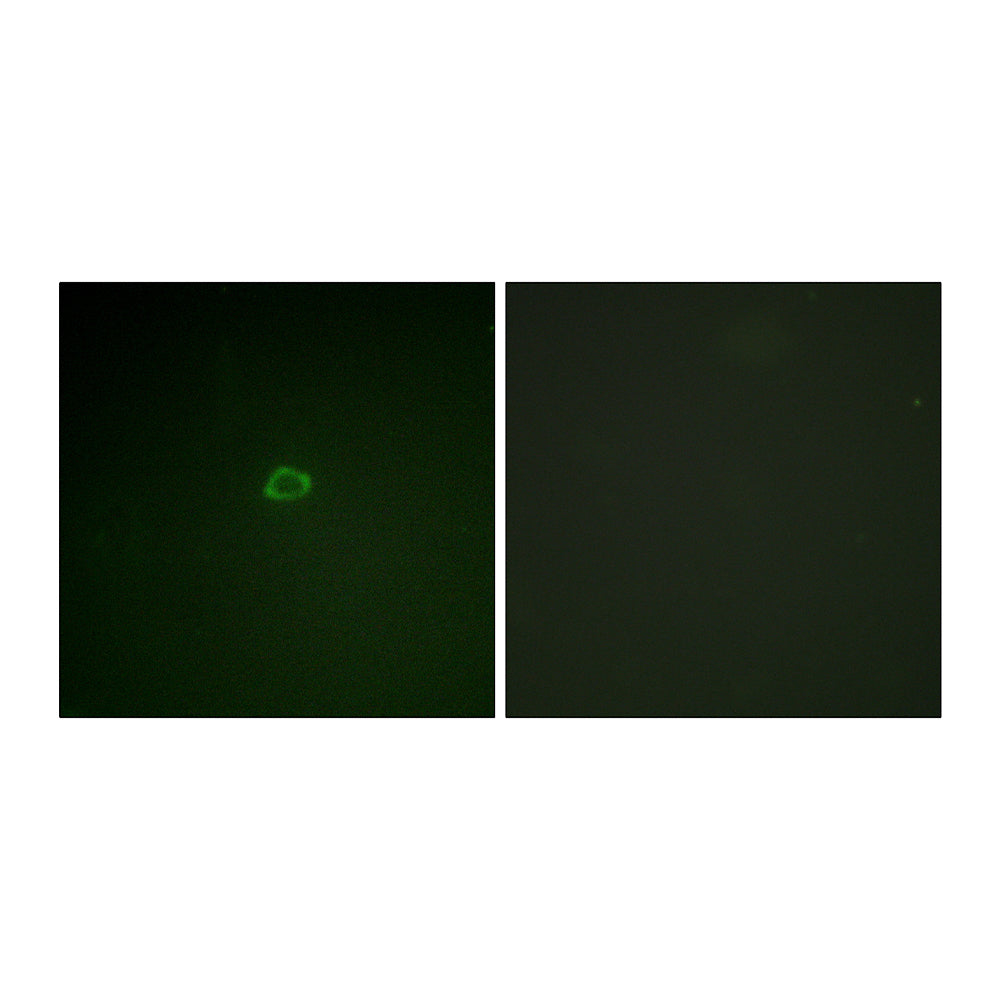 4E-BP1 Polyclonal Antibody, 20ul[BT-AP00035]