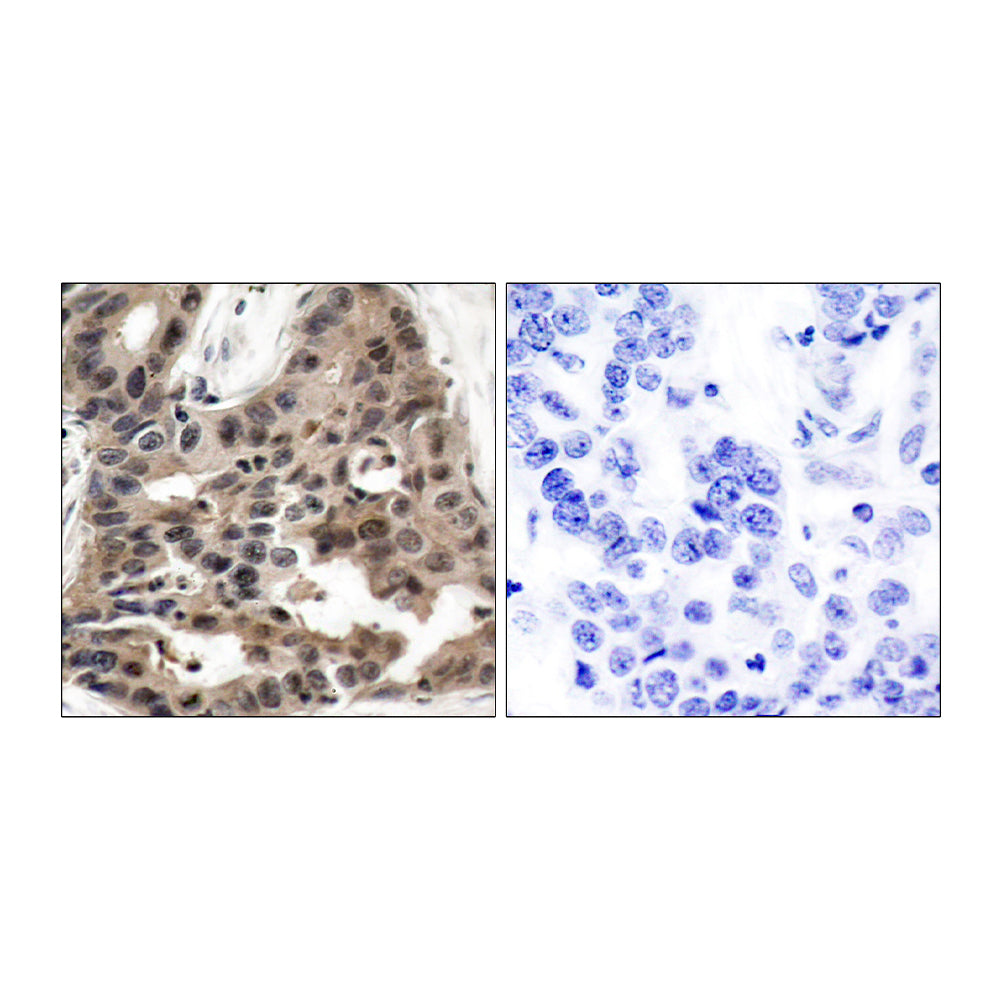 4E-BP1 Polyclonal Antibody, 20ul[BT-AP00036]