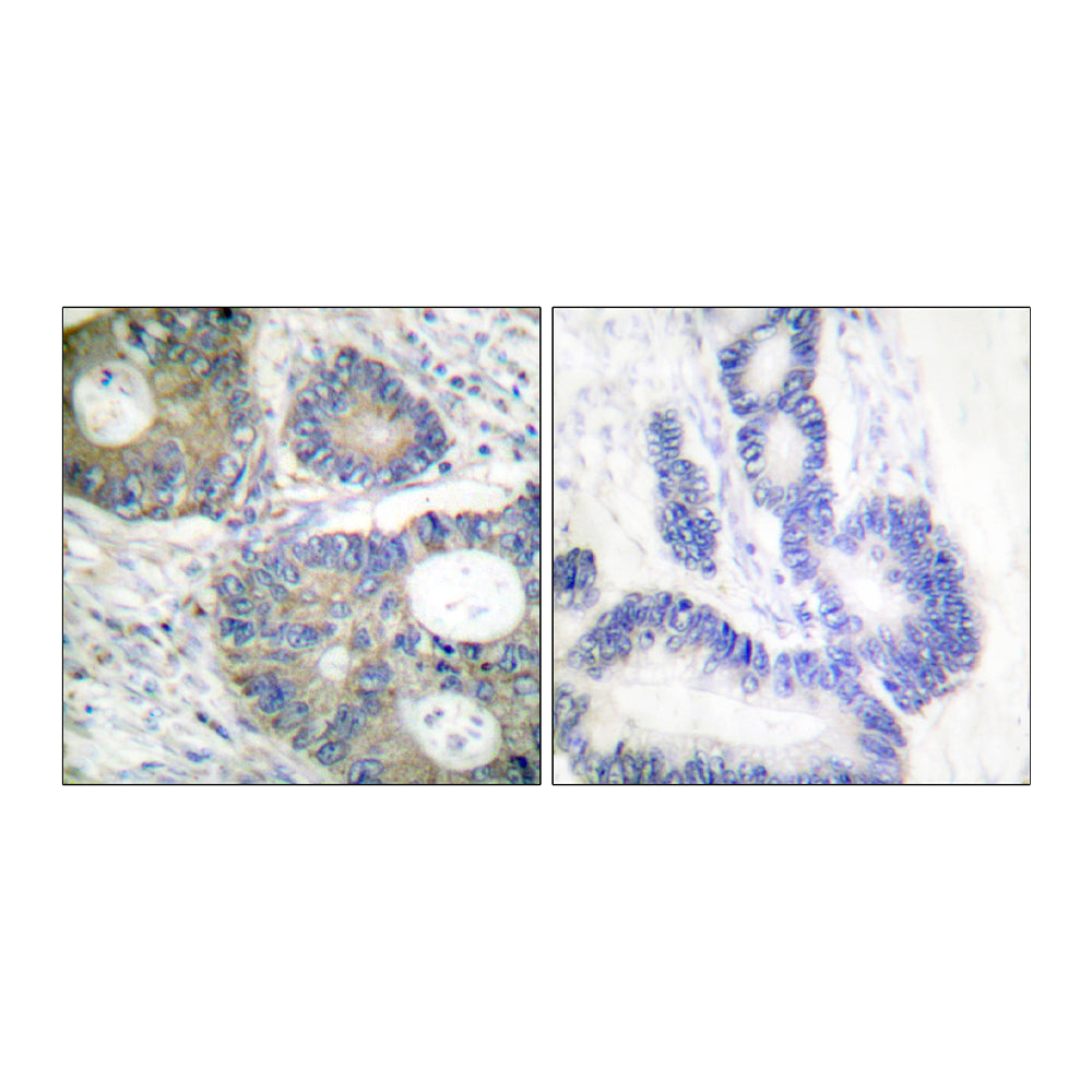 4E-BP1 Polyclonal Antibody, 20ul[BT-AP00037]