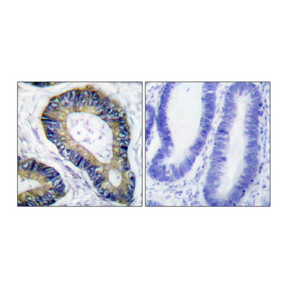 4E-BP1 Polyclonal Antibody, 100ul[BT-AP00038]