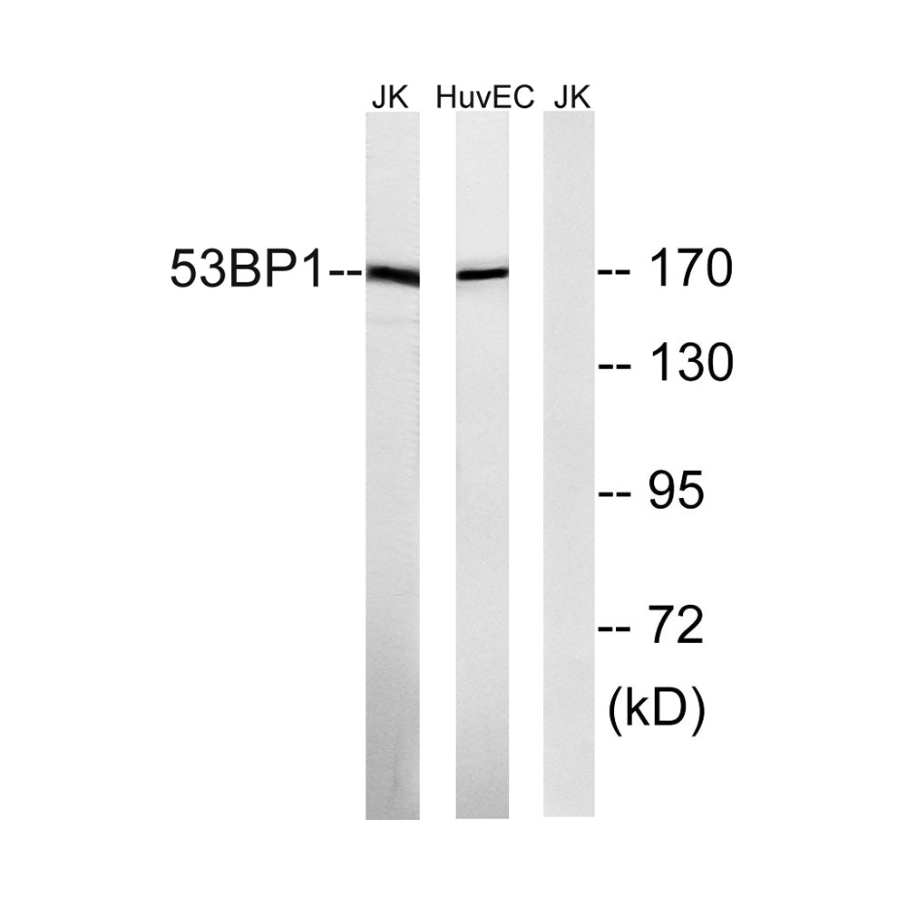 53BP1 Polyclonal Antibody, 100ul[BT-AP00041]