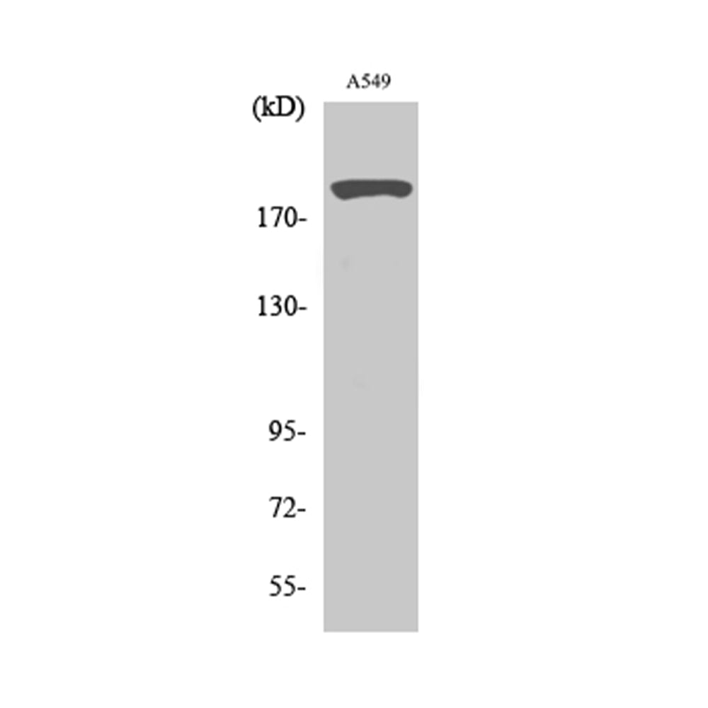 53BP1 Polyclonal Antibody, 100ul[BT-AP00042]