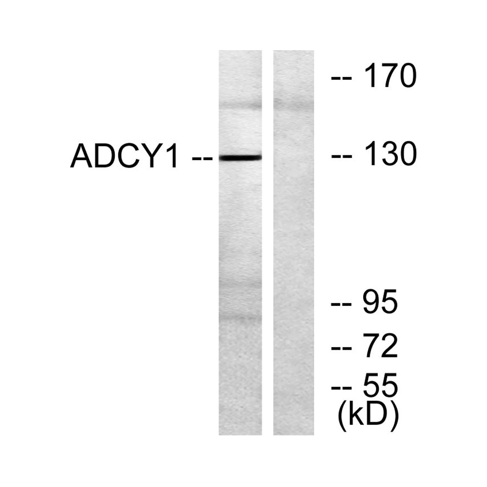 A Cyclase I Polyclonal Antibody, 100ul