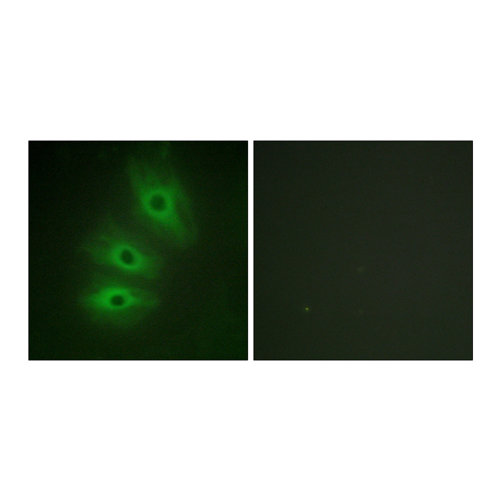 A Cyclase V/VI Polyclonal Antibody, 100ul[BT-AP00054]