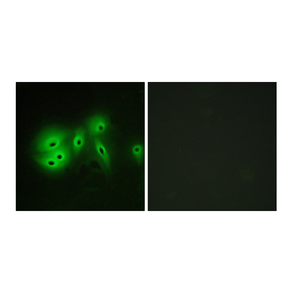 A Cyclase VIII Polyclonal Antibody, 100ul