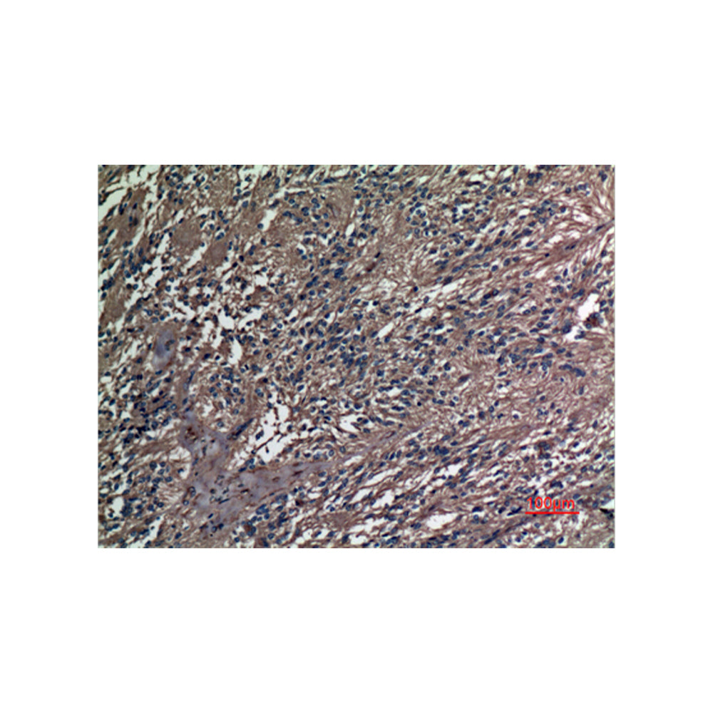A1BG Polyclonal Antibody, 100ul