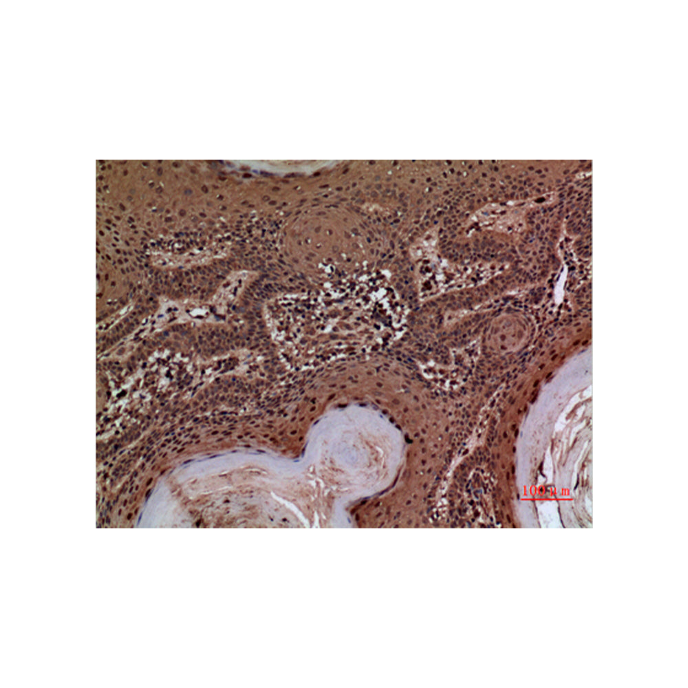 AACT Polyclonal Antibody, 100ul