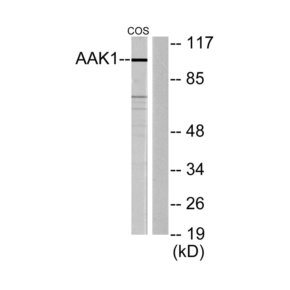 AAK1 Polyclonal Antibody, 100ul
