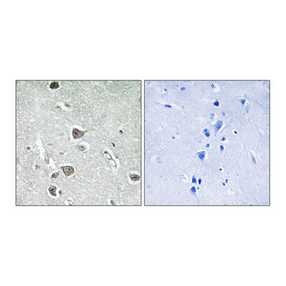 AASD-PPT Polyclonal Antibody, 100ul