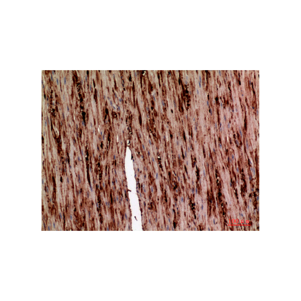 AAT Polyclonal Antibody, 100ul[BT-AP00074]