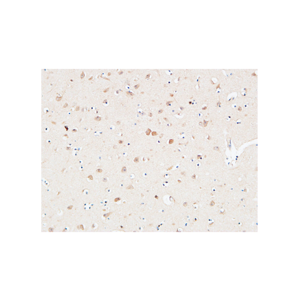 AAT Polyclonal Antibody, 100ul[BT-AP00075]
