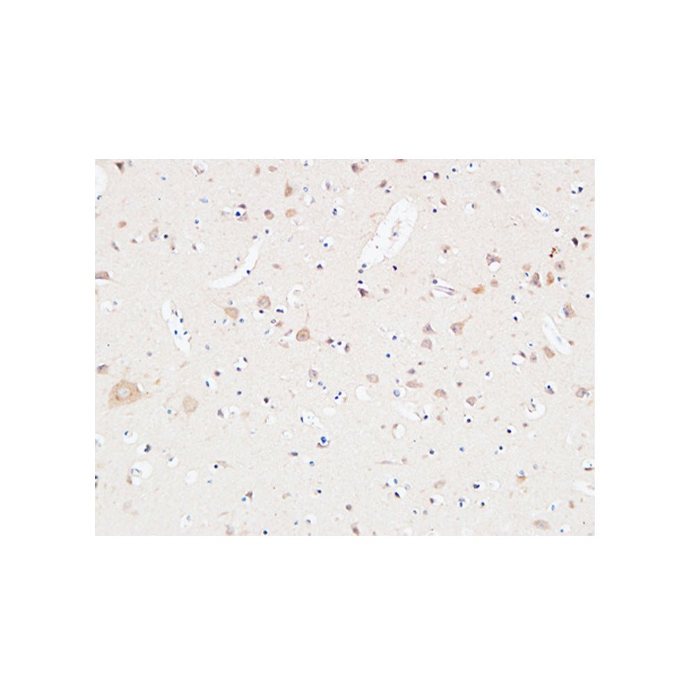 AAT Polyclonal Antibody, 20ul[BT-AP00075]
