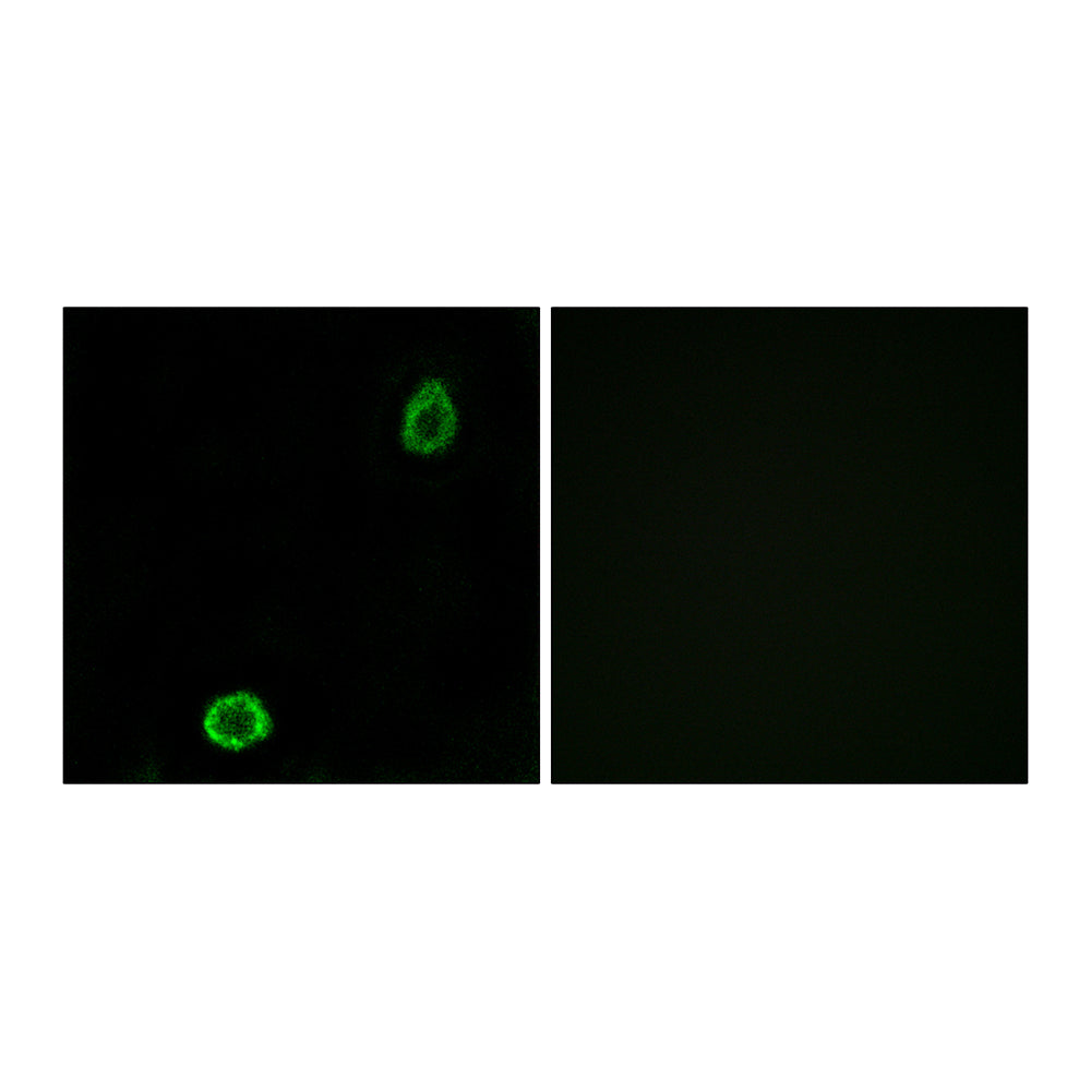 ABCA13 Polyclonal Antibody, 100ul