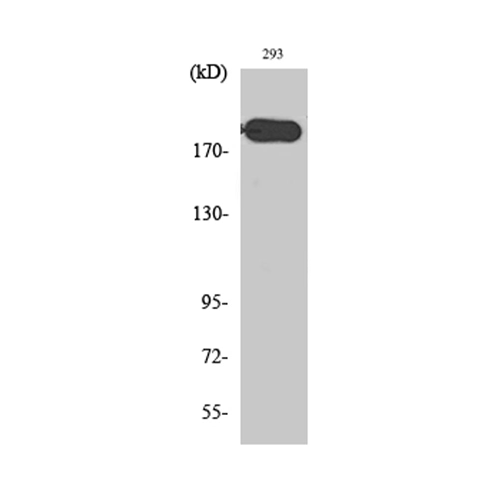 ABCA6 Polyclonal Antibody, 100ul