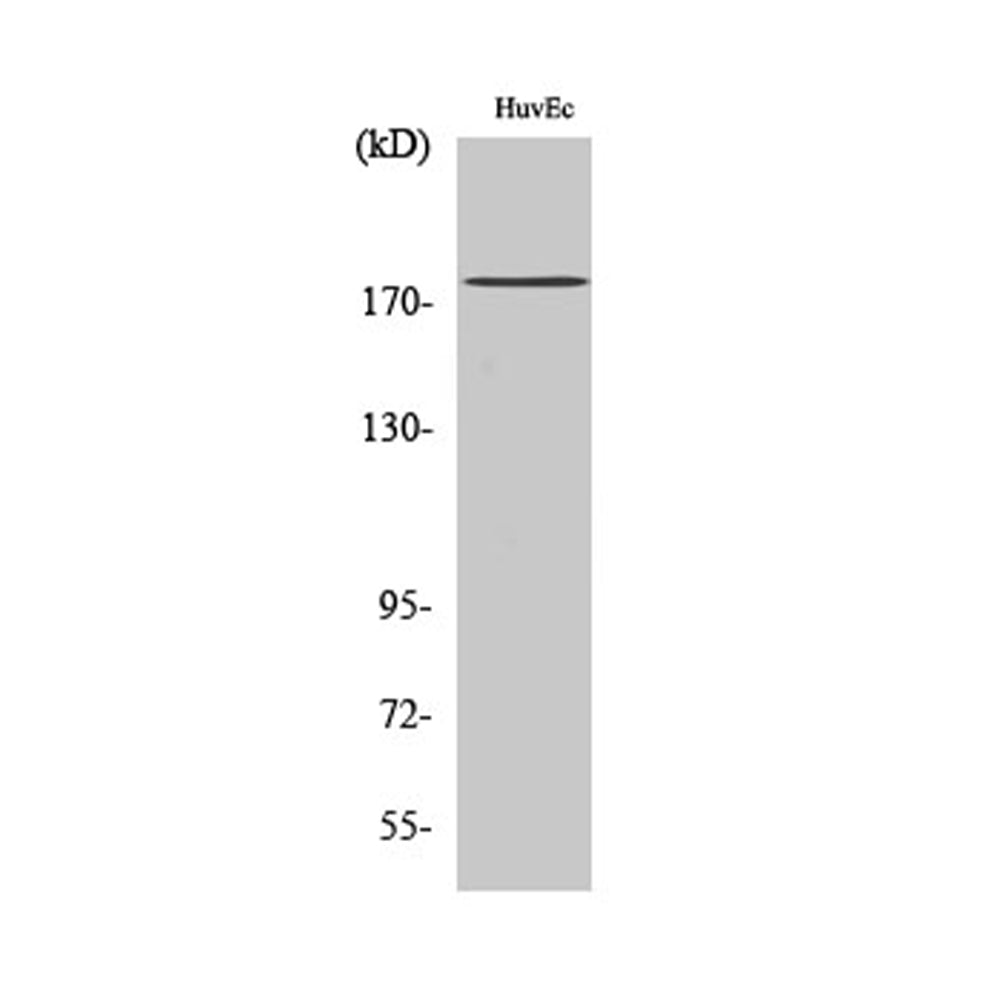 ABCA8 Polyclonal Antibody, 100ul