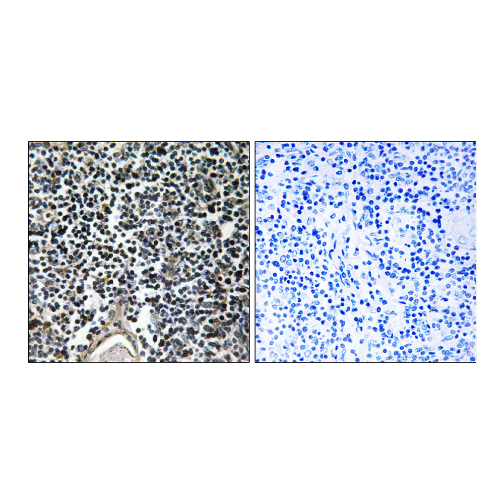 ABCB7 Polyclonal Antibody, 100ul