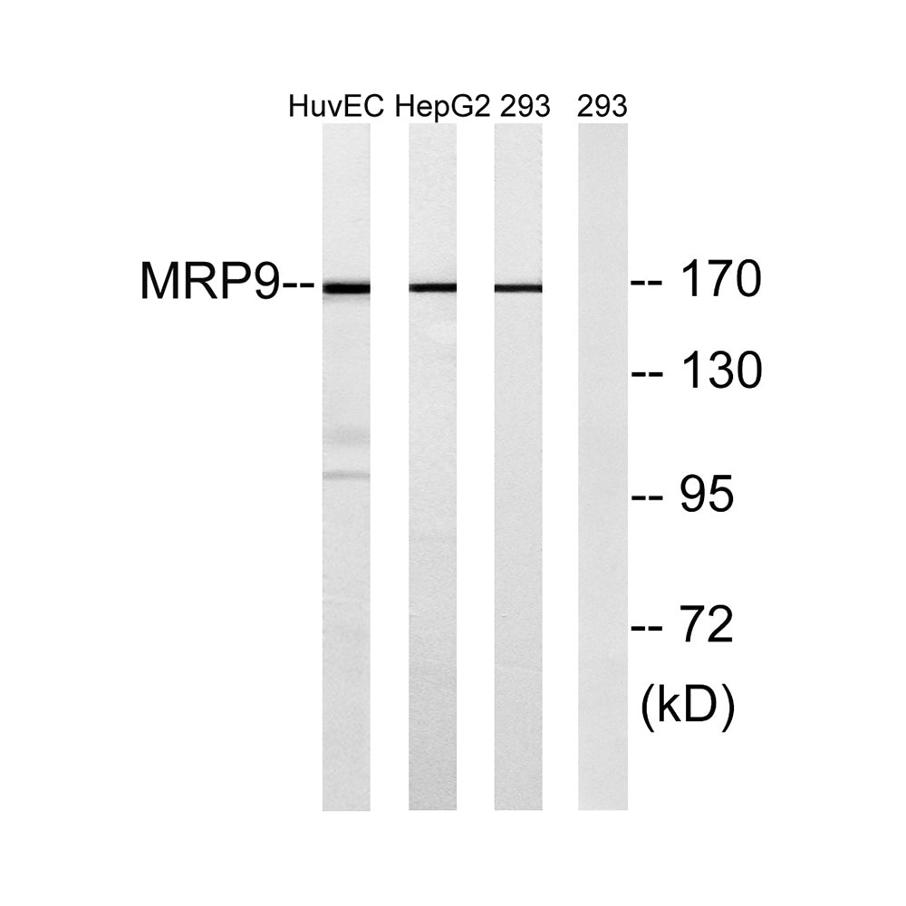 ABCC12 Polyclonal Antibody, 100ul