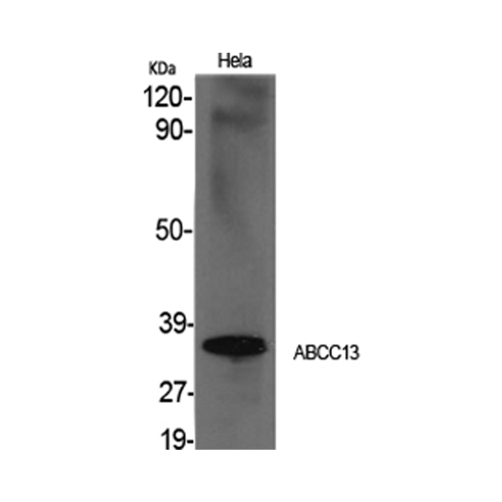 ABCC13 Polyclonal Antibody, 100ul