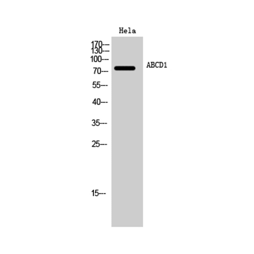 ABCD1 Polyclonal Antibody, 100ul