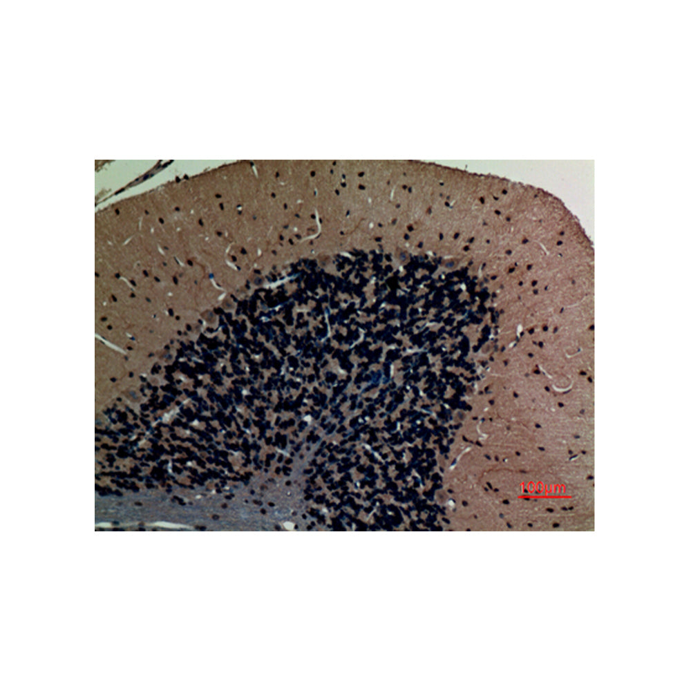 ABCG1 Polyclonal Antibody, 100ul