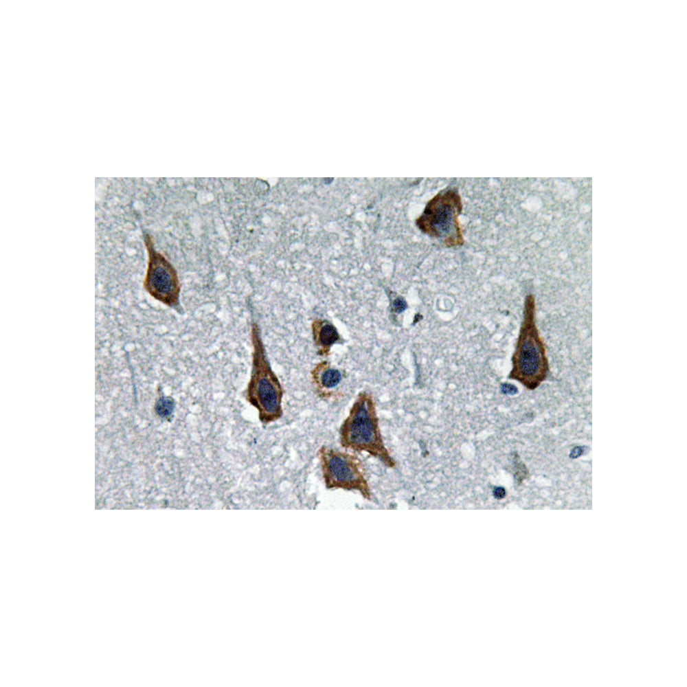 ABCG2 Polyclonal Antibody, 100ul