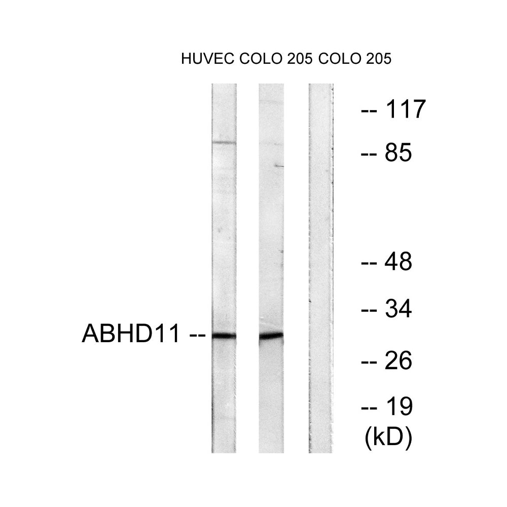 ABHD11 Polyclonal Antibody, 100ul