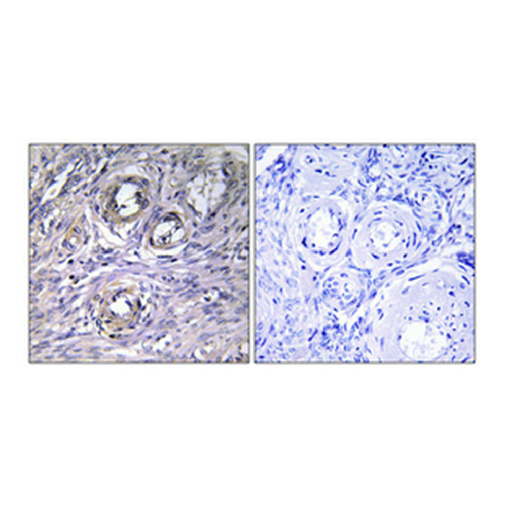 ABHD12 Polyclonal Antibody, 100ul
