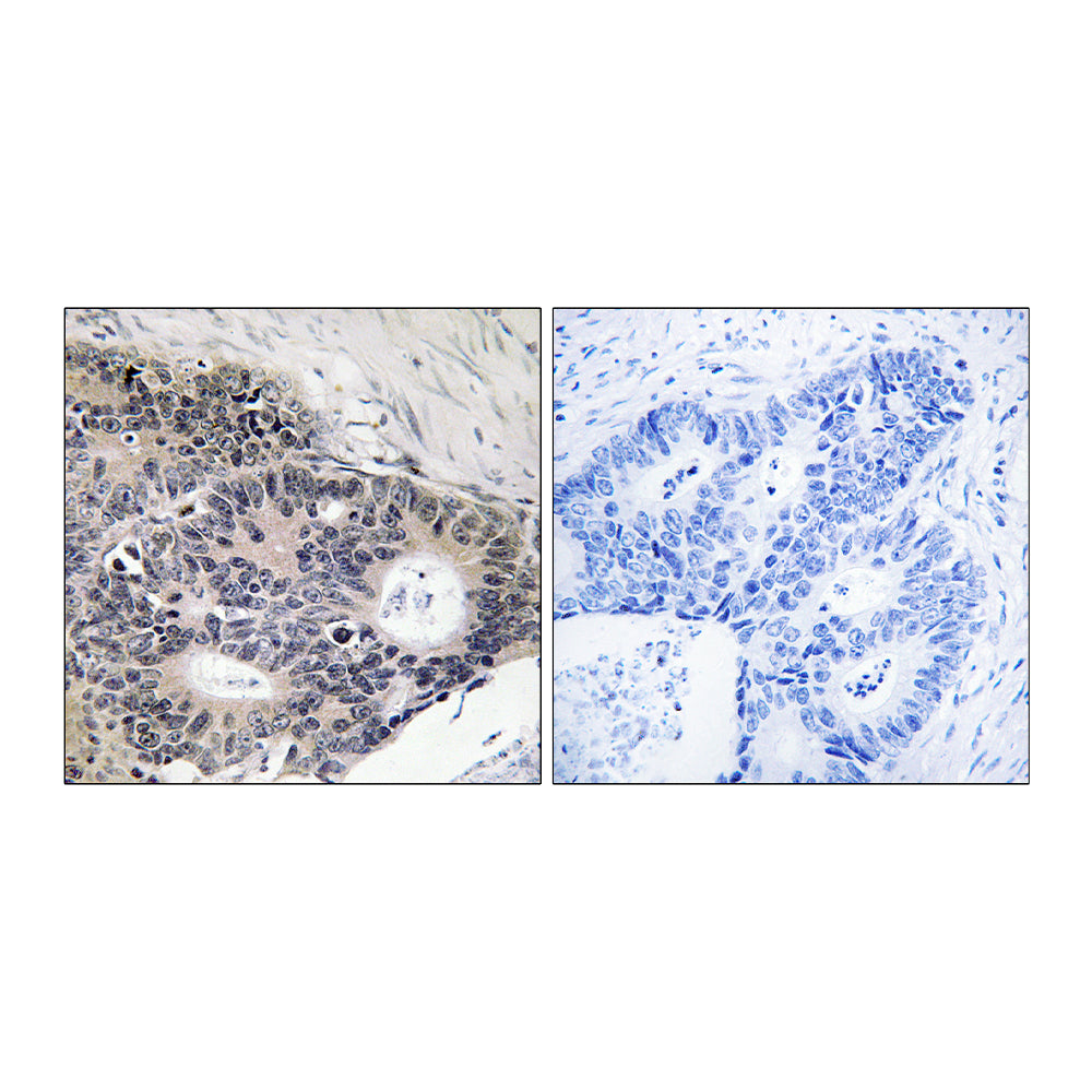 ABHD12B Polyclonal Antibody, 100ul