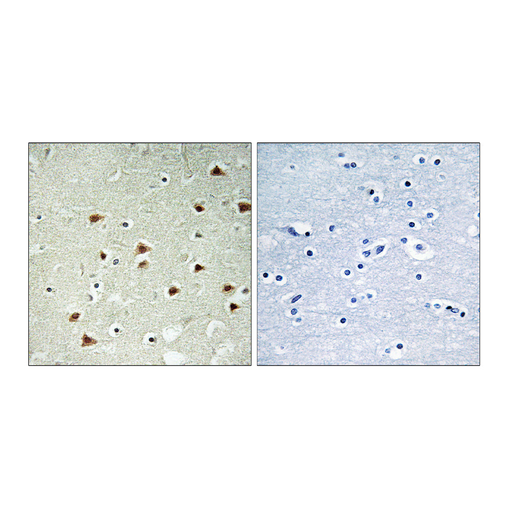 ABHD14B Polyclonal Antibody, 100ul