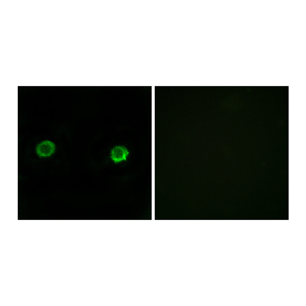 ABHD2 Polyclonal Antibody, 100ul