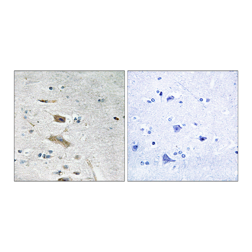 ABHD4 Polyclonal Antibody, 100ul