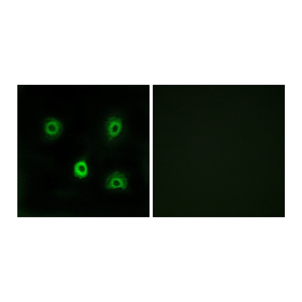 ABHD6 Polyclonal Antibody, 100ul