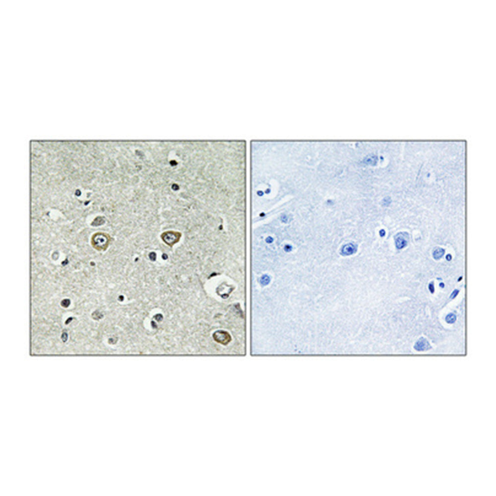 ABHD8 Polyclonal Antibody, 100ul