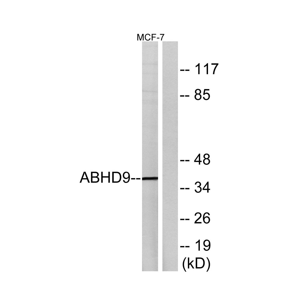 ABHD9 Polyclonal Antibody, 100ul