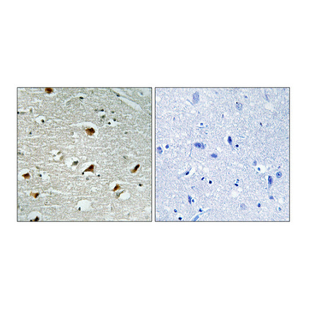 Abl1 Polyclonal Antibody, 20ul[BT-AP00132]