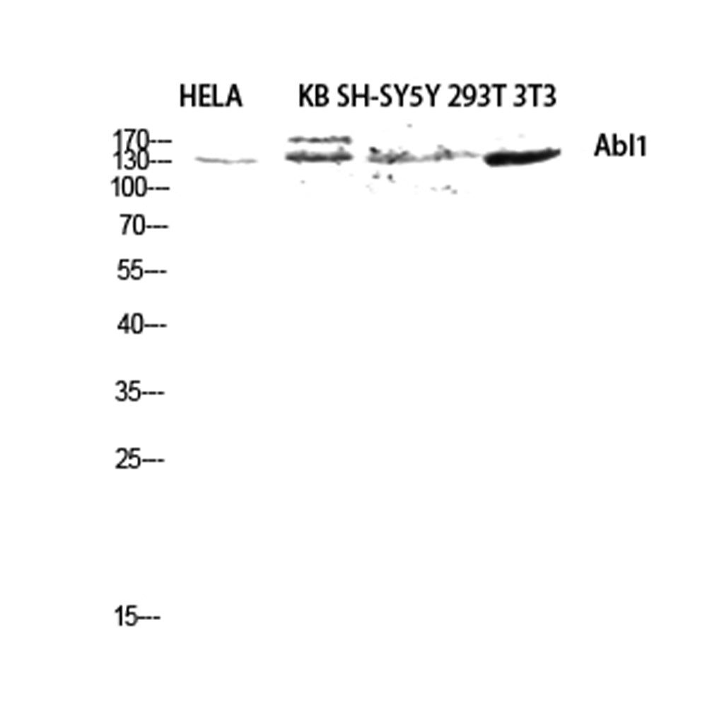 Abl1 Polyclonal Antibody, 20ul[BT-AP00133]