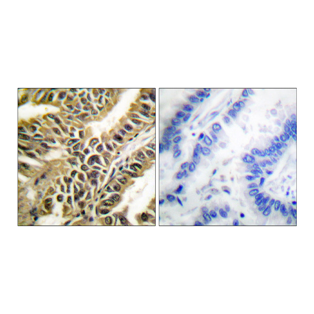 Abl1/2 Polyclonal Antibody, 20ul[BT-AP00134]