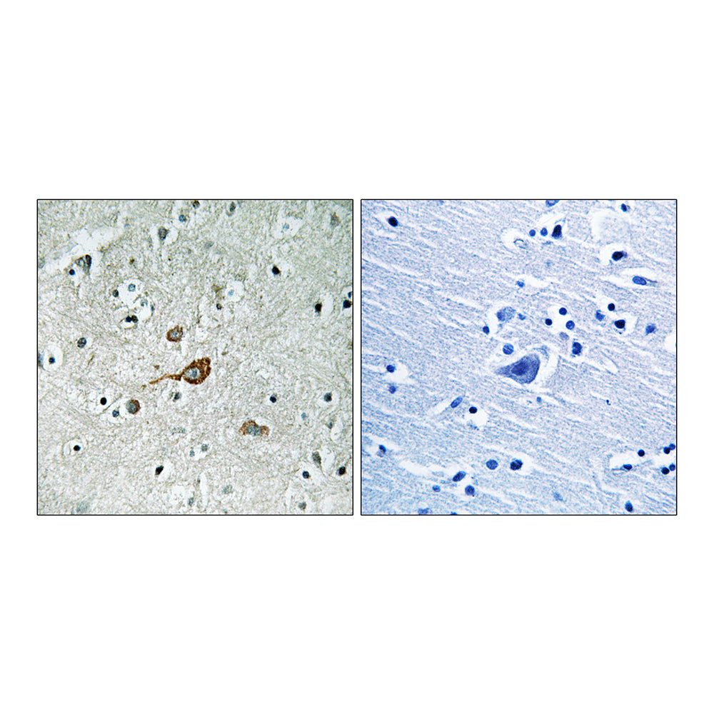 Abl1/2 Polyclonal Antibody, 20ul[BT-AP00135]