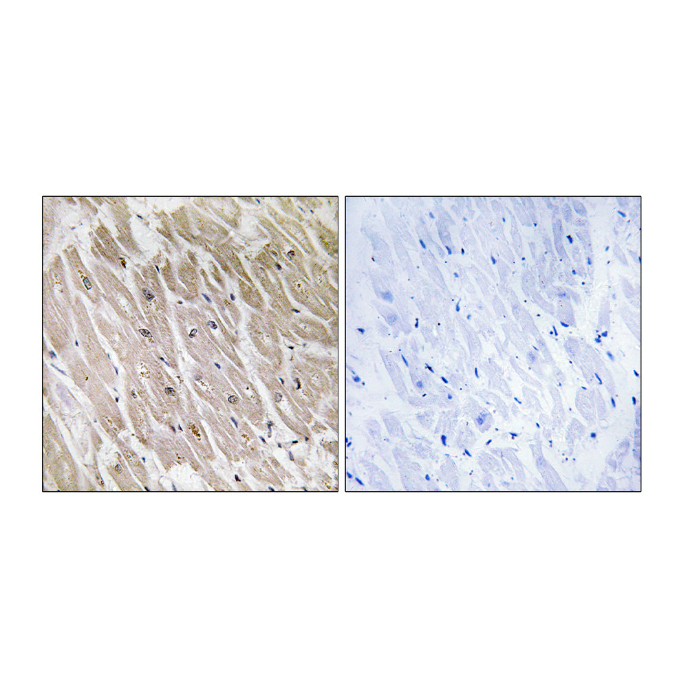 ACAD-10 Polyclonal Antibody, 20ul