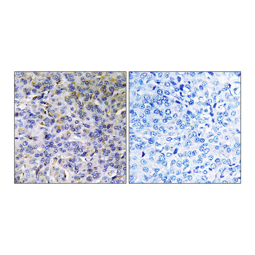 ACAD-11 Polyclonal Antibody, 20ul